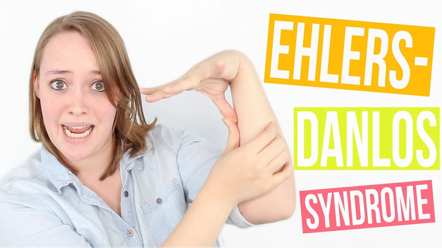 23 Signs You Grew Up With Ehlers Danlos Syndrome