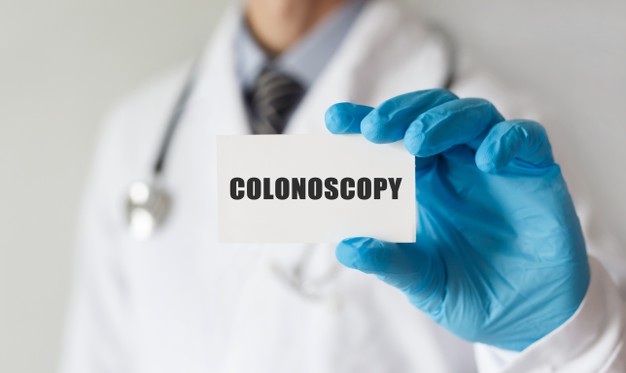 Colonoscopy timing
